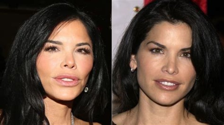 Lauren Sanchez Before Surgery