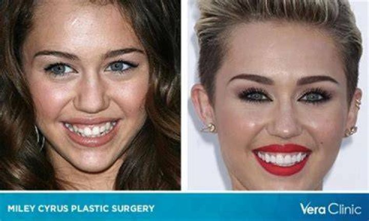 Tish Cyrus Plastic Surgery